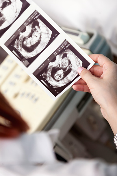 Doctor Looking At Ultrasound Scan Of Baby - 写真・画像