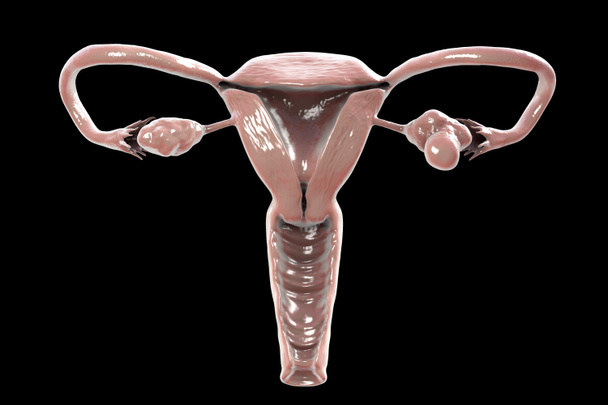 多嚢胞性卵巣症候群、健康な卵巣を示す3Dイラスト(右)と嚢胞と卵巣を拡大(左)) - 写真・画像