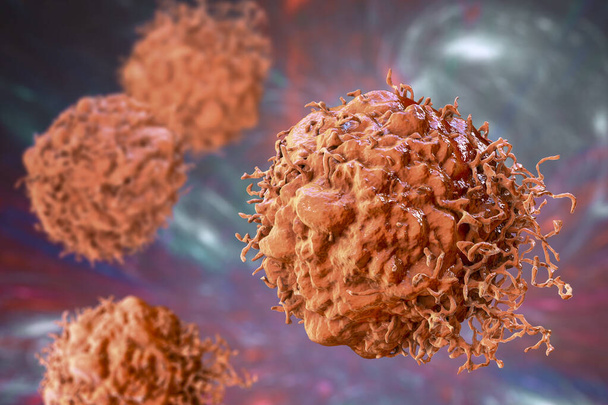 Καρκινοκύτταρα, κακοήθη κύτταρα, επιστημονική τρισδιάστατη απεικόνιση - Φωτογραφία, εικόνα