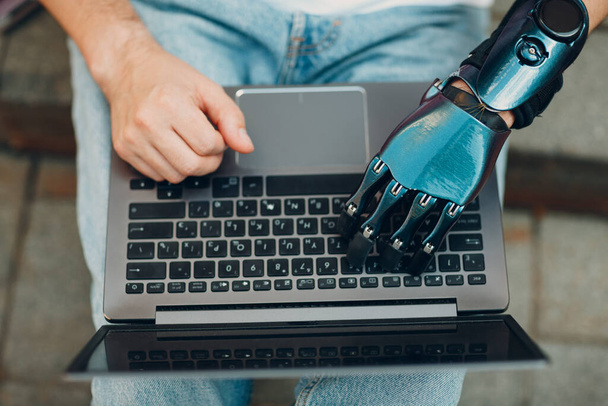 Молодой инвалид с искусственной протезной рукой с помощью ввода на клавиатуре ноутбука. - Фото, изображение