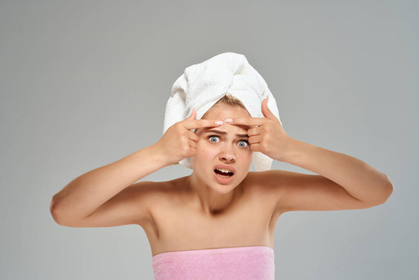 woman with bare shoulders and a towel on her head pimples on her face close-up - Foto, Bild