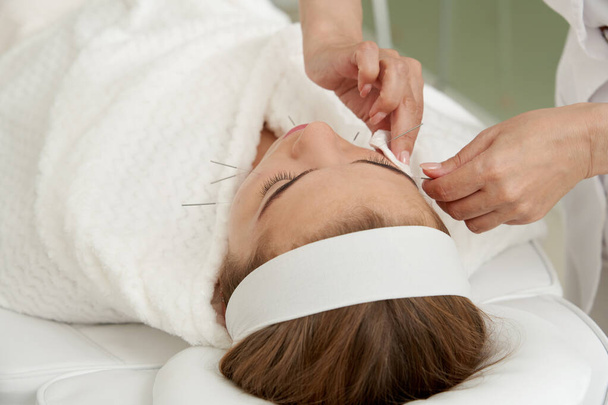 El médico pone agujas en la cara femenina en la terapia de tratamiento de acupuntura en el salón de spa. Concepto de medicina alternativa - Foto, imagen