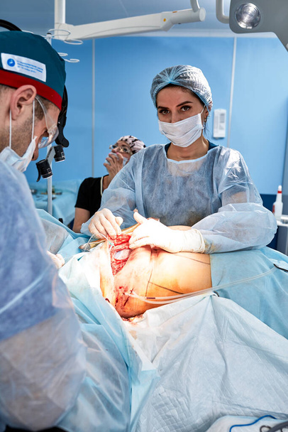 Der Arzt führt eine Operation durch, um die weibliche Brust zu rekonstruieren. Nahaufnahme eines plastischen Chirurgen, der Implantationsverfahren durchführt, Brustkrebs - Foto, Bild