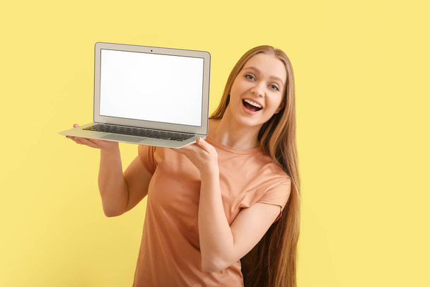 Beautiful young woman holding laptop with blank screen on color background - Foto, Imagem
