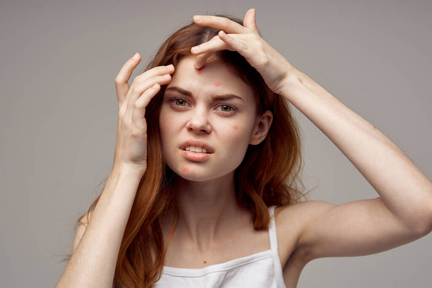 rousse femme problèmes de peau du visage dermatologie gros plan - Photo, image