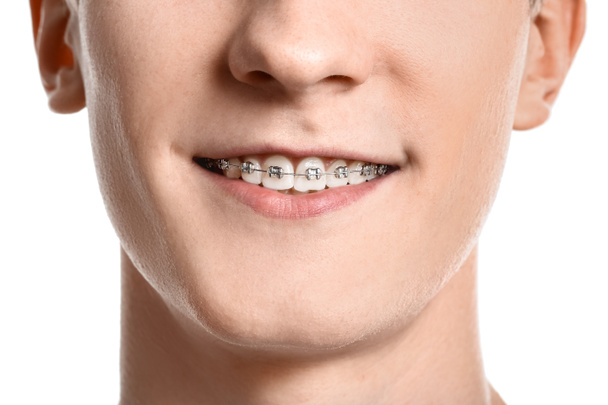 Hombre guapo con frenos dentales sobre fondo blanco, primer plano - Foto, Imagen