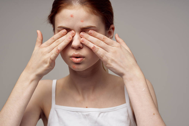 mulher bonita problemas de pele facial dermatologia close-up - Foto, Imagem