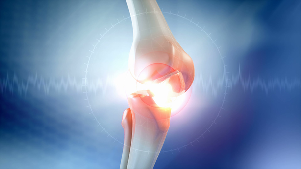 koleno bolest animace - Záběry, video