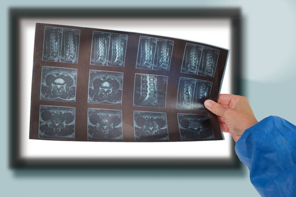Un medico tiene le mani e analizza la radiografia della colonna vertebrale a raggi X  - Foto, immagini