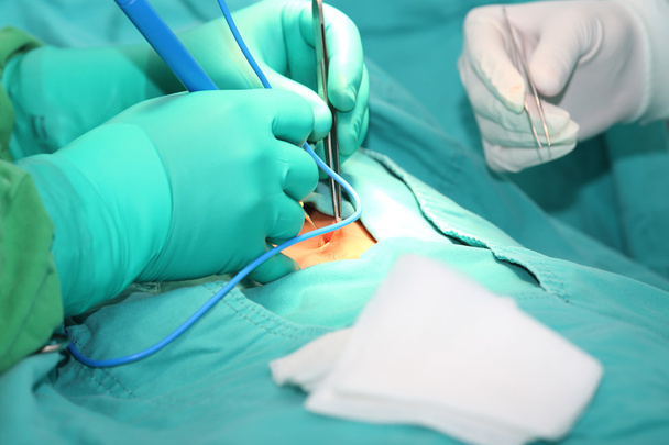 Medico che utilizza un bisturi elettronico in chirurgia
 - Foto, immagini