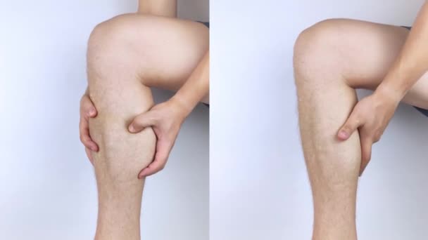 Antes y después. En el hombre izquierdo se aferra al músculo de la pantorrilla porque duele mucho. A la derecha los médicos han curado la lesión y no hay más dolor. Esguince de ligamento y ruptura muscular - Metraje, vídeo