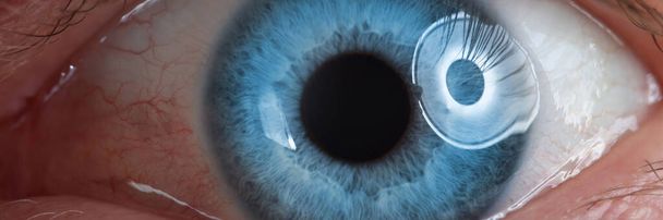 人間の目は青い。成人における視力器官の検査 - 写真・画像