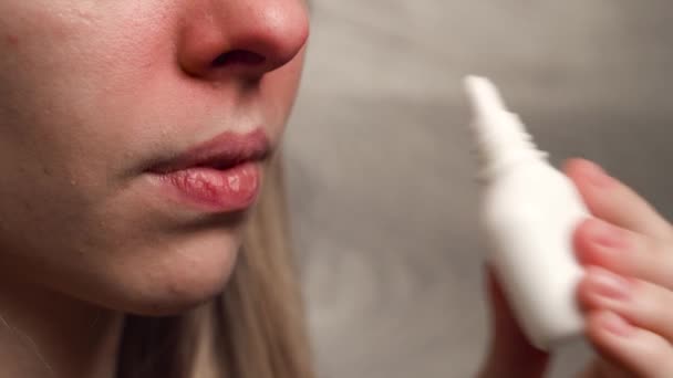Het meisje behandelt neusverstopping. close-up. neusspray. - Video