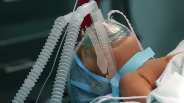 Unidentified child with oxygen mask ready for surgery - Footage, Video