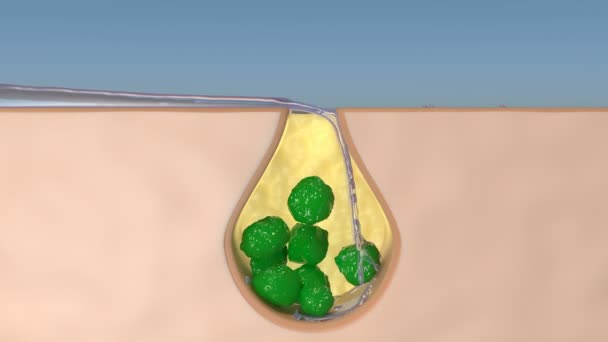 Cuidado de la salud Limpieza profunda de la piel Capa Agua Limpieza de bacterias verdes - Metraje, vídeo