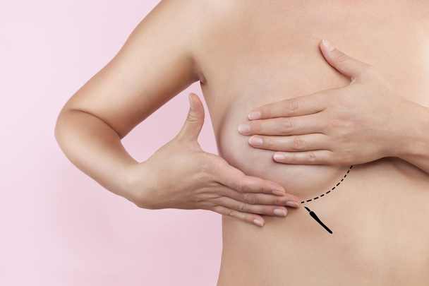 Увеличение груди - Фото, изображение