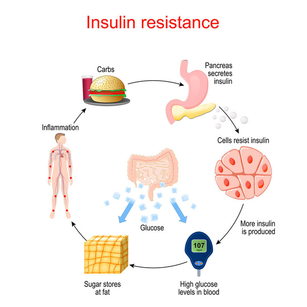 Инсулиновая стойкость. патологическое состояние, при котором клетки не реагируют нормально на гормональный инсулин. Цикл инсулина и глюкозы. - Вектор,изображение