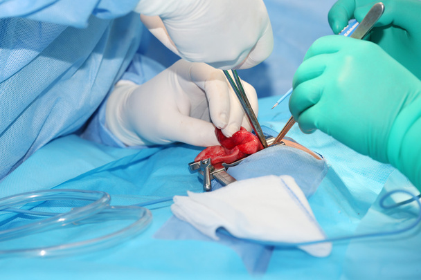 Lungenemphysem-Operation an einem 4 Monate alten Jungen im Operationssaal - Foto, Bild