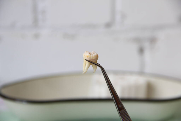Extracted tooth in the tweezers - Photo, Image