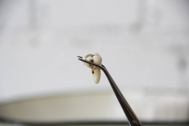Extracted tooth in tweezers against the background of the dental tray - Photo, Image