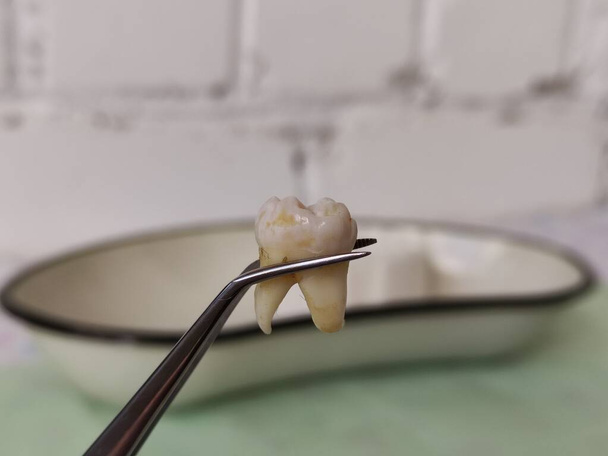 Diente extraído en pinzas contra el fondo de la bandeja dental - Foto, Imagen