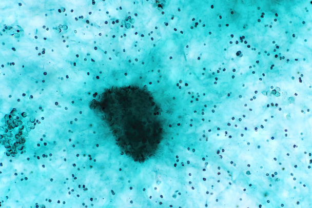 Aspergillus (hometta) valossa mikroskooppinen näkymä mikrobiologia koulutus.  - Valokuva, kuva