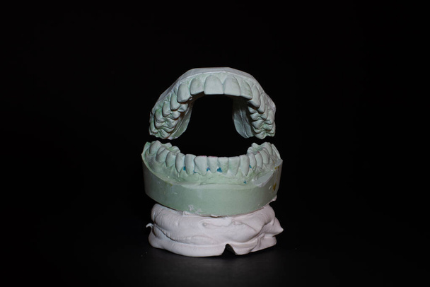 Gesso Modello dentale di denti umani su sfondo nero. - Foto, immagini