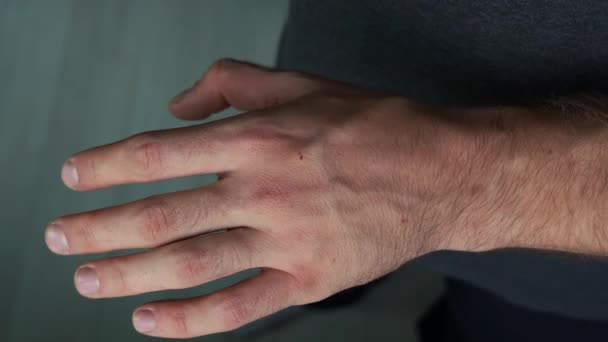 man onderzoekt zijn hand 4k beeldmateriaal - Video