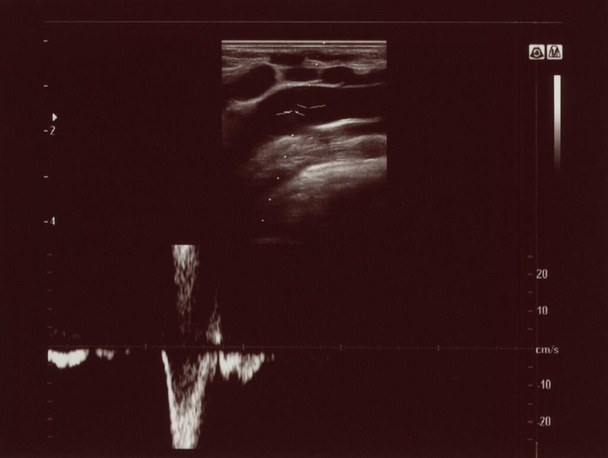 échographie diagnostique aka échographie technique d'imagerie diagnostique basée sur l'échographie utilisée pour visualiser les structures internes du corps - Photo, image