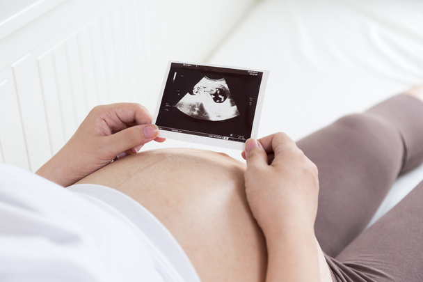 Pregnant belly with ultrasound photo - Φωτογραφία, εικόνα