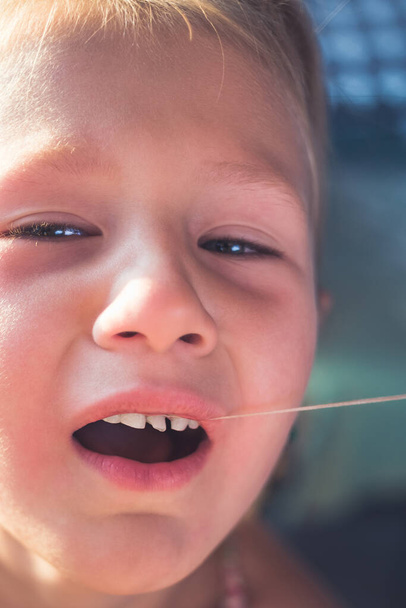 El proceso de remover un diente de bebé usando un hilo. - Foto, Imagen