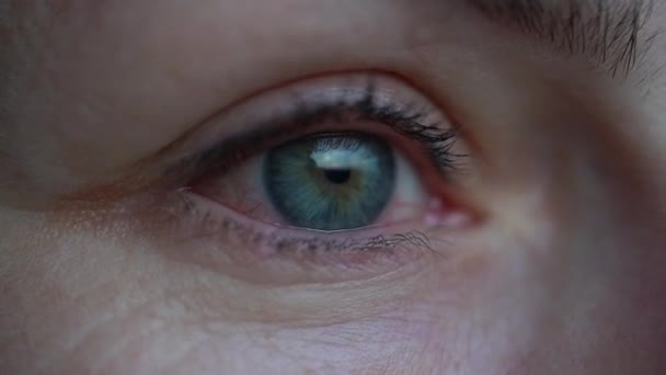Irritált, száraz vörös szem vagy allergia. Nő szenved a bőrpír. Kötőhártya-gyulladás, keratitis - Felvétel, videó