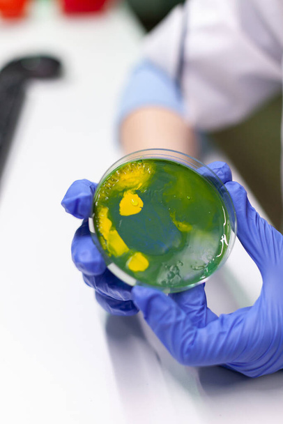 Nahaufnahme einer Ärztin mit Petrischale und Pilzkolonie - Foto, Bild