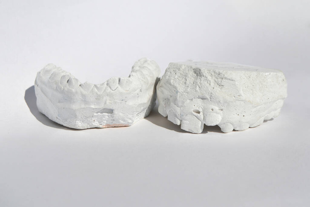 歯の石膏モデルは、胃の人間の顎をキャスト - 写真・画像