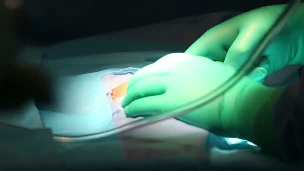 sebész jelzi a területet, hogy nyitva van a szike - Felvétel, videó