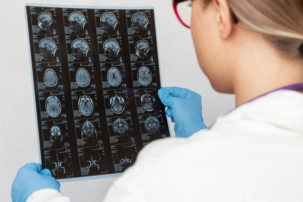 Rezonans magnetyczny mózgu tomografią komputerową w rękach lekarza. Młoda blond lekarz badający MRI głowy i mózgu pacjenta na białym tle. - Zdjęcie, obraz