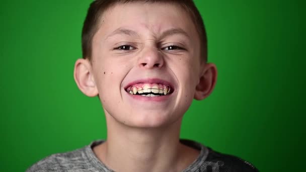 Lächeln Baby, Junge trägt einen Teller zum Ausrichten der Zähne, Zahnpflege. - Filmmaterial, Video