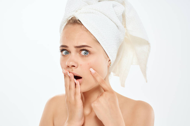 женщина с полотенцем на голове с акне на лице - Фото, изображение