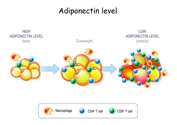 Nivel de adiponectina. Las personas magras tienen alto nivel de adiponectina, las personas con sobrepeso tienen bajo nivel de adiponectina. Adipocitos en el tejido graso, macrófagos y células T en el tejido adiposo con inflamación - Vector, Imagen