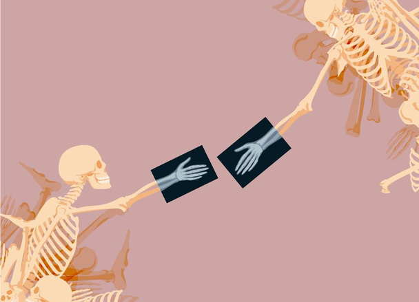 Les squelettes s'étirent les mains l'un vers l'autre. Composition sculpturale créative avec os et rayons X - Vecteur, image