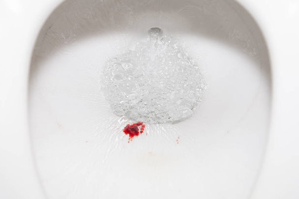 Sangre y papel higiénico en un inodoro con agua baja y enjuagada - Foto, imagen