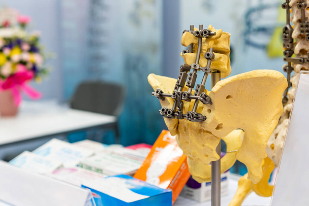 mintaszerkezet mutatja csípőcsont és gerinc csont fém rögzítés az asztalon - Fotó, kép