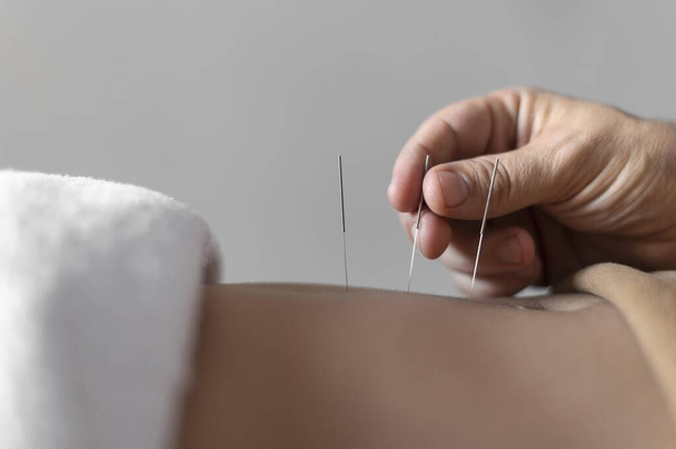 close up hand holding acupuncture needle. High quality beautiful photo concept - Photo, Image
