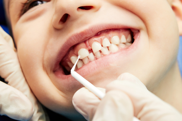 Pediatrik dişçi küçük dişleri kontrol ediyor. - Fotoğraf, Görsel