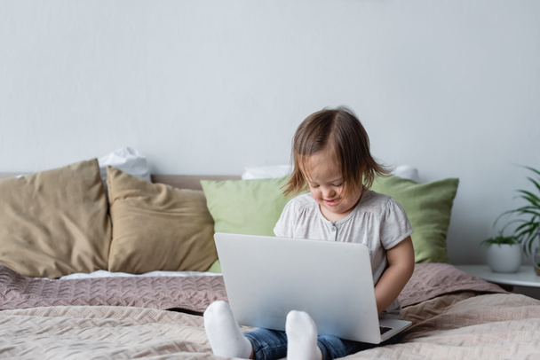 Smiling girl with down syndrome using laptop on bed at home  - Φωτογραφία, εικόνα