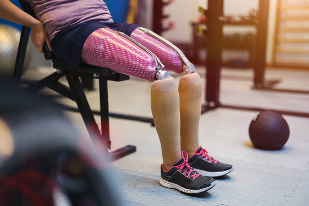 Young woman with prosthetic legs exercising at physiotherapy center - Zdjęcie, obraz