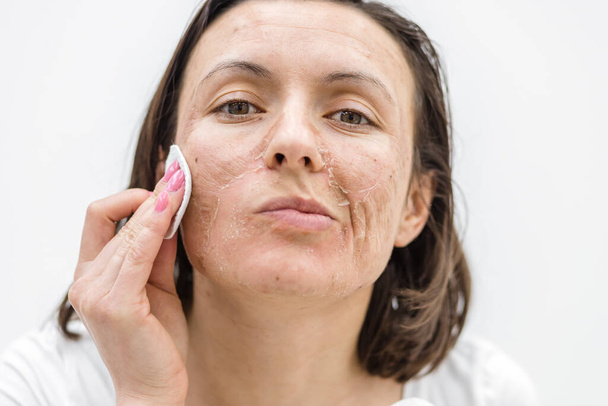 Close up photo of woman cleaning face with cosmetic sponge. Concept of skincare. - Foto, Imagem