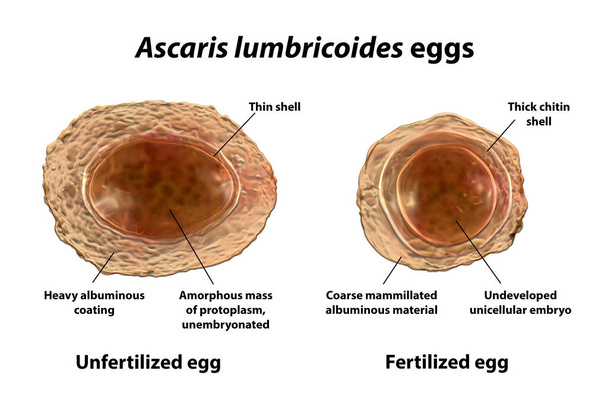 Ascaris lumbricoides, a large roundworm, unfertilized and fertilized eggs, 3D illustration - Photo, Image