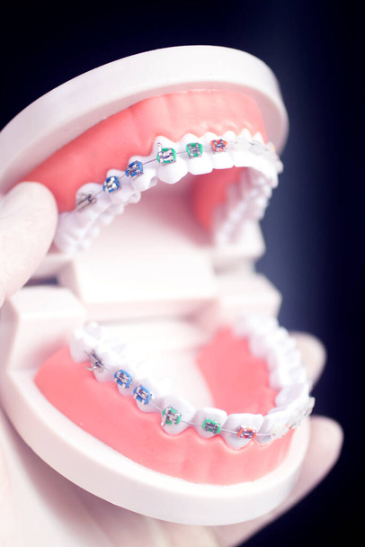 Support d'alignement de dents dentaires enseignant le modèle étudiant montrant les gencives et les redresseurs de dents métalliques. - Photo, image