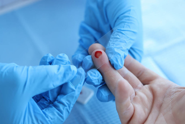 El médico toma muestras de sangre para comprobar el primer nivel de hemoglobina - Foto, Imagen